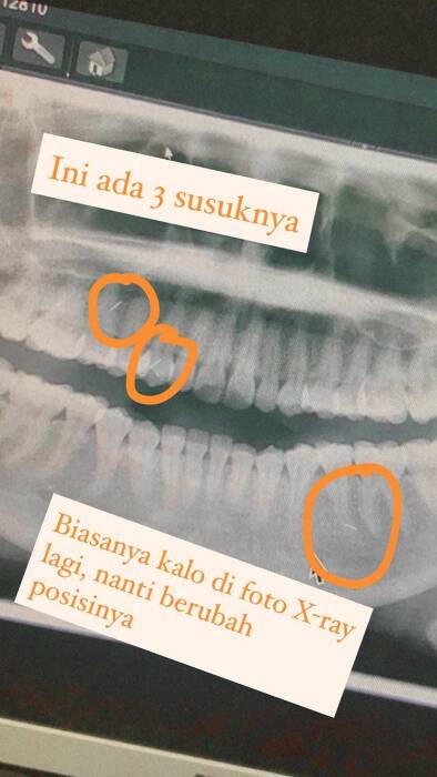 Instagram/tasyabira Instagram/tasyabira