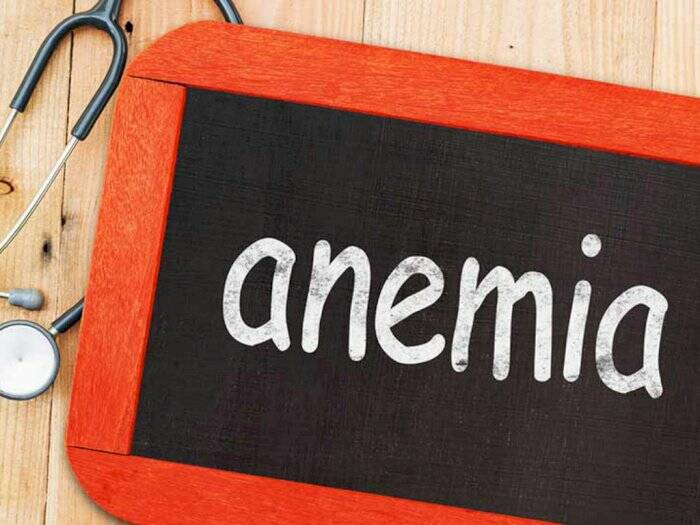 Ilustrasi anemia. (familydoctor.org) Jangan Dibuang, Ini Manfaat Biji Nangka untuk Kesehatan Tubuh