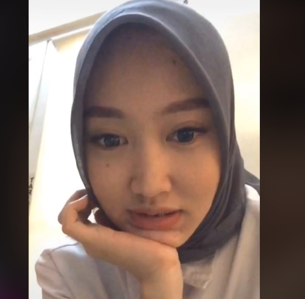 Wajah teller bank cantik sebelum wajahnya penuh jerawat video viral, viral, teller bank jerawatan