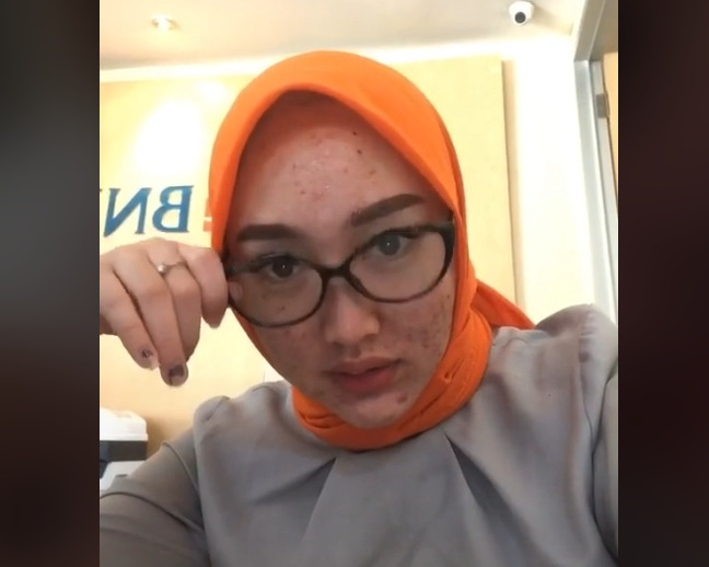 Wajah teller bank mulai membaik kondisi jerawatnya video viral, viral, teller bank jerawatan