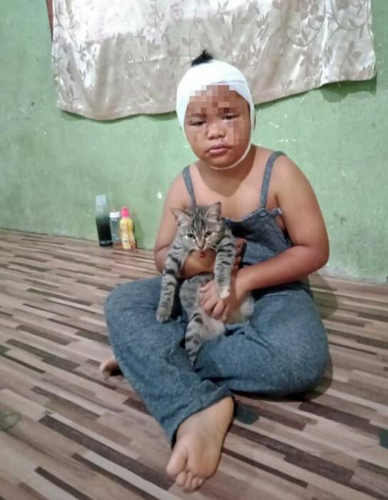 Muhammad Adam Harith Husyazi yang mengalami luka parah karena dicakar kucing. (Photo/mStar) dicakar kucing