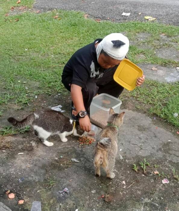 Muhammad Adam Harith Husyazi yang mengalami luka parah karena dicakar kucing. (Photo/mStar) dicakar kucing