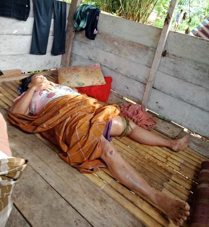 Korban gempa di Mamuju di lokasi pengungsian. (Ist)